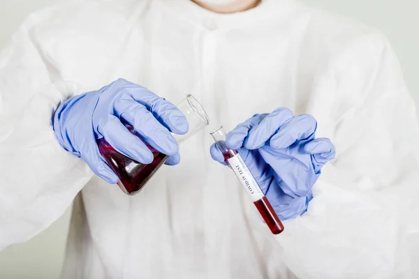 Dokter Beschermende Kleding Houdt Reageerbuis Met Bloed Voor Coronavirus Covid — Stockfoto