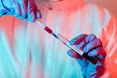 Korumalı giysideki doktor Coronavirus COVID-19 analizi için kanla test tüpü tutuyor. Grip aşısı, koronavirüs, ebola..