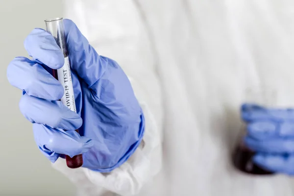 Врач Защитном Износе Держит Пробирку Кровью Анализа Коронавируса Covid Вакцина — стоковое фото