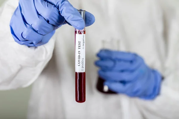 Врач Защитном Износе Держит Пробирку Кровью Анализа Коронавируса Covid Вакцина — стоковое фото
