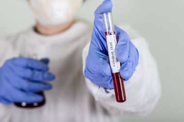 Korumadaki doktor Coronavirus COVID-19 analizi için kan testleri yapıyor. Grip aşısı, koronavirüs, ebola..
