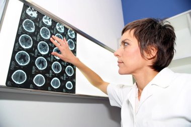 Endocranium CT (bilgisayarlı tomografi), Ct kafa 