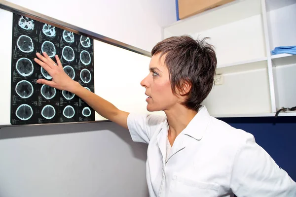 TC (tomografia computerizzata) dell'endocranio, TC della testa — Foto Stock