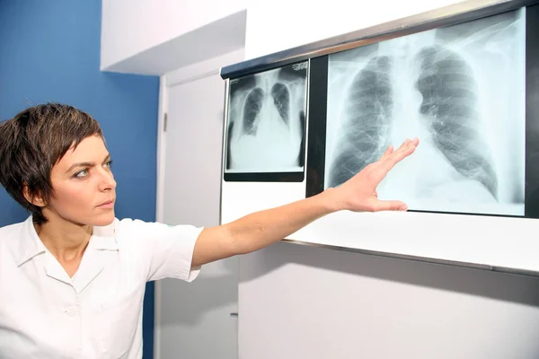 X-ışını akciğer, akciğer embolism(Pe), pulmoner hipertansiyon, C