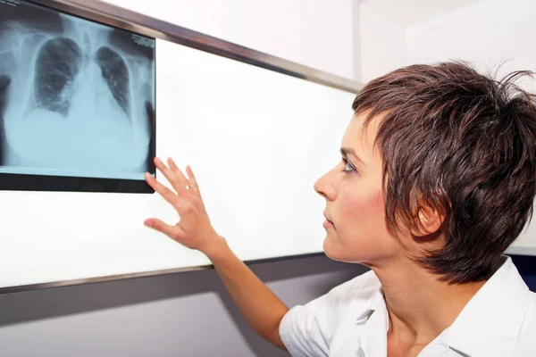 Radiografia de pulmão, embolia pulmonar (EP), hipertensão pulmonar, C — Fotografia de Stock