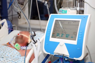 Mekanik havalandırma, kritik hasta hasta