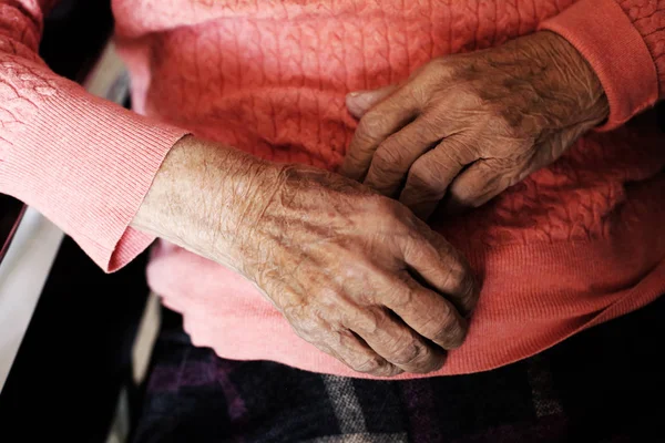 Sluit de handen van een oude vrouw. rimpelhuid. — Stockfoto