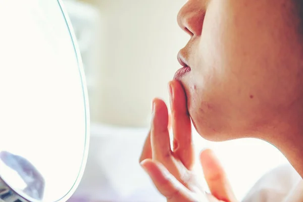 Închide Fata care aplică gel de aloe pe pielea problematică cu acnee sc — Fotografie, imagine de stoc