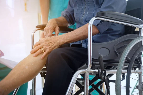Пожилая или пожилая женщина пациентка пациентка показать свои шрамы хирургическим — стоковое фото