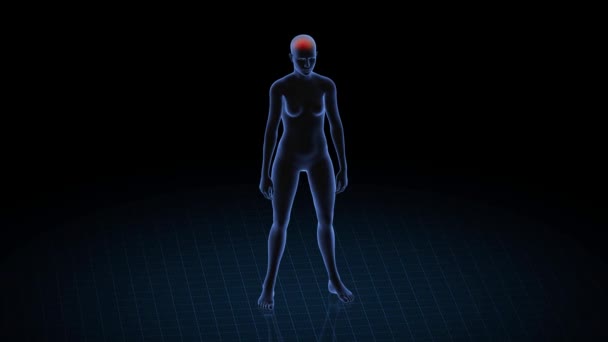 Chica Con Dolor Cabeza Patología Cuerpo Mujeres Animación Rotatoria Primer — Vídeos de Stock