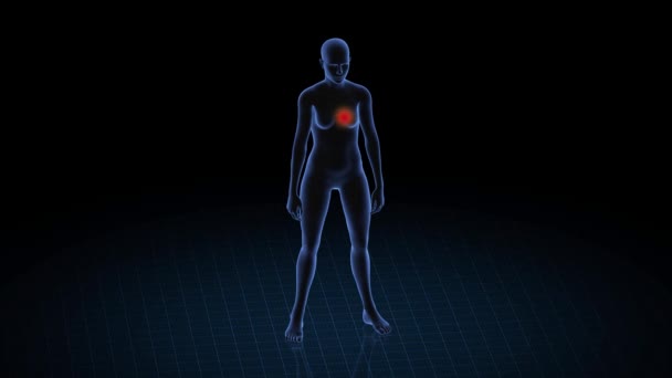 Meisje Met Hartpathologie Lichaam Van Vrouwen Roterende Animatie Close Van — Stockvideo