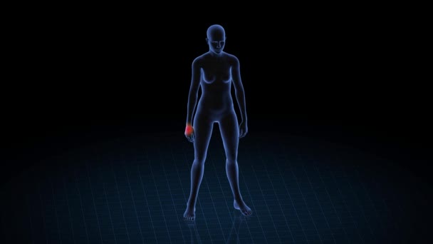 Chica Con Patología Manos Cuerpo Mujeres Animación Rotatoria Primer Plano — Vídeos de Stock