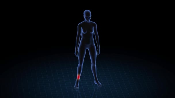 Chica Con Patología Del Tobillo Cuerpo Mujeres Animación Rotatoria Primer — Vídeos de Stock