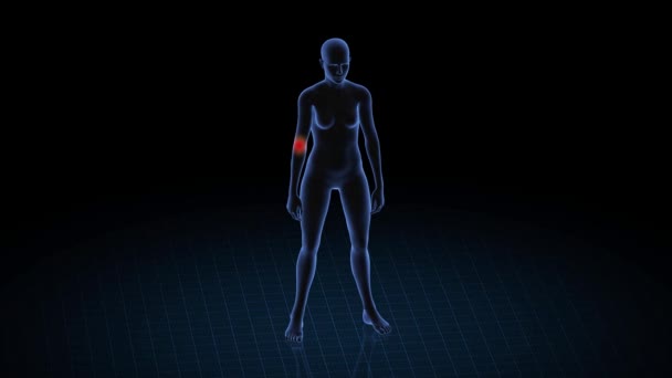 X-ray style - medical 3d animation of a female having acute pain in the back — Stock Video © .com #147121697 X-ray style - medical 3d animation of a female having acute pain in the back — Stock Video © .com #147121697