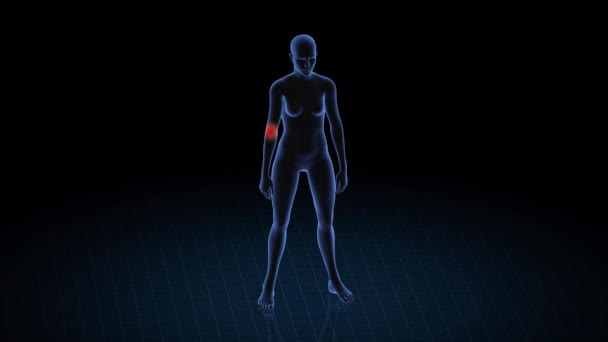 Chica Con Patología Del Codo Cuerpo Mujeres Animación Rotatoria Primer — Vídeos de Stock