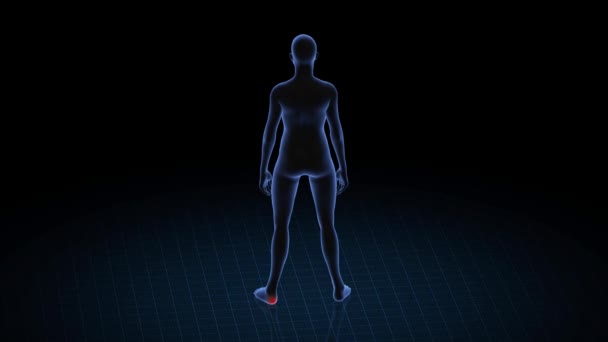 Chica Con Patología Del Talón Cuerpo Mujeres Animación Rotatoria Primer — Vídeos de Stock