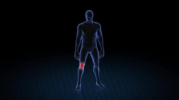 Mann Mit Knieproblemen Körper Des Jungen Rotierende Animation Und Nahaufnahme — Stockvideo