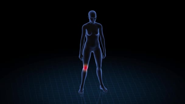 Chica Con Patología Rodilla Cuerpo Mujeres Animación Rotatoria Primer Plano — Vídeo de stock