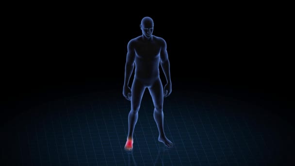 Ayak Patolojisi Olan Bir Adam Çocuğun Boyutlu Vücudu Dönen Animasyon — Stok video