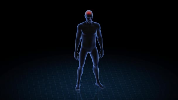 Baş Ağrısı Olan Bir Adam Çocuğun Boyutlu Vücudu Dönen Animasyon — Stok video