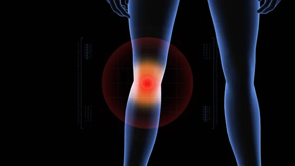 膝盖病理学的女孩3D具女性尸体 女性人类结构的轮转和特写 Hud — 图库照片