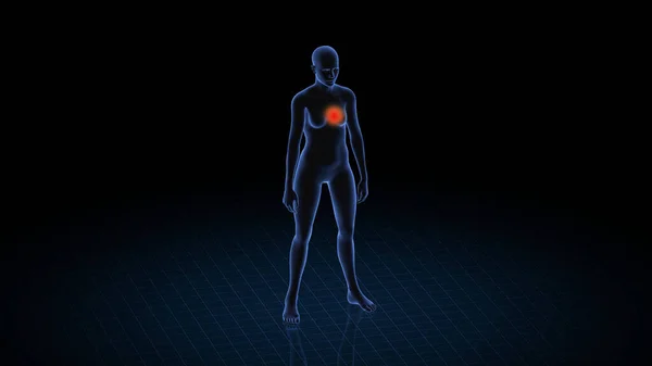 有心脏病理学的女孩3D具女性尸体 女性人类结构的轮转和特写 Hud — 图库照片