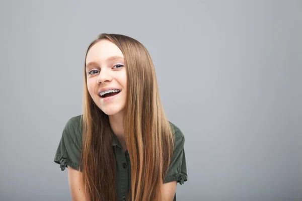 Красива усмішка дівчина з брекетами сміється — стокове фото