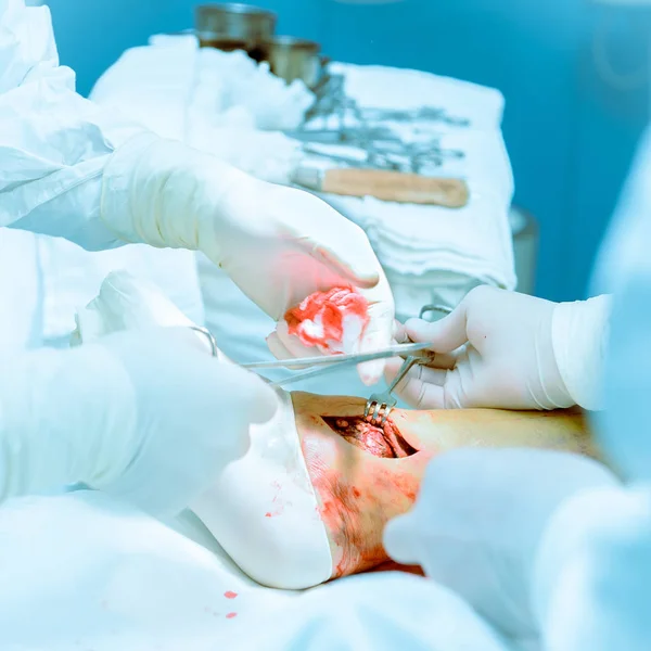 Doktorlar bir hastanın ameliyat