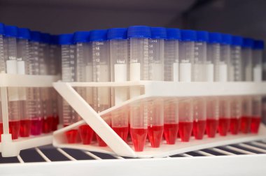 Laboratuvardaki bir buzdolabında hasta analizi yapılan bir mataranın kapanışı. Coronavirus testi. Nüfusun aşılanması