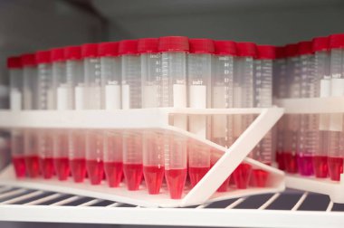Laboratuardaki buzdolabında hasta analizi yapılan kırmızı şapkalı mataralar. Coronavirus testi. Nüfusun aşılanması