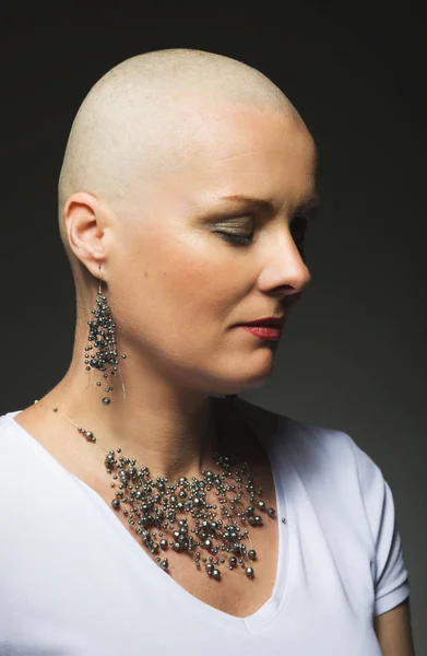 Beautiful middle age woman cancer patient without hair — Stock Photo, Image