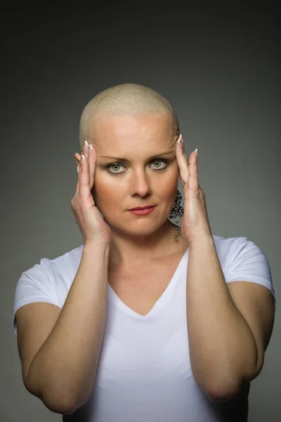 Güzel orta yaş kadın kanser hastası saç olmadan — Stok fotoğraf
