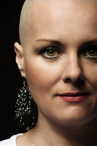 Belle femme d'âge moyen cancer patient sans cheveux — Photo