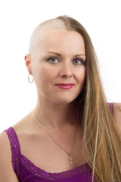 美丽的中年女人癌症病人没有头发 — 图库照片