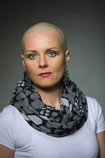 Hermosa mujer de mediana edad cáncer paciente sin pelo — Foto de Stock