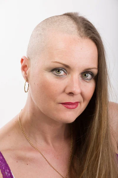 Hermosa mujer cáncer paciente — Foto de Stock