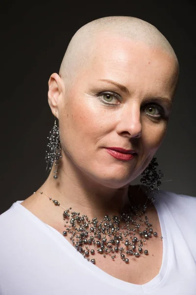 Hermosa mujer cáncer paciente sin pelo — Foto de Stock