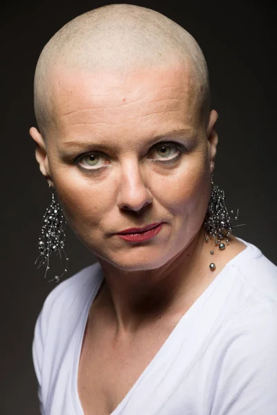 Hermosa mujer cáncer paciente sin pelo — Foto de Stock