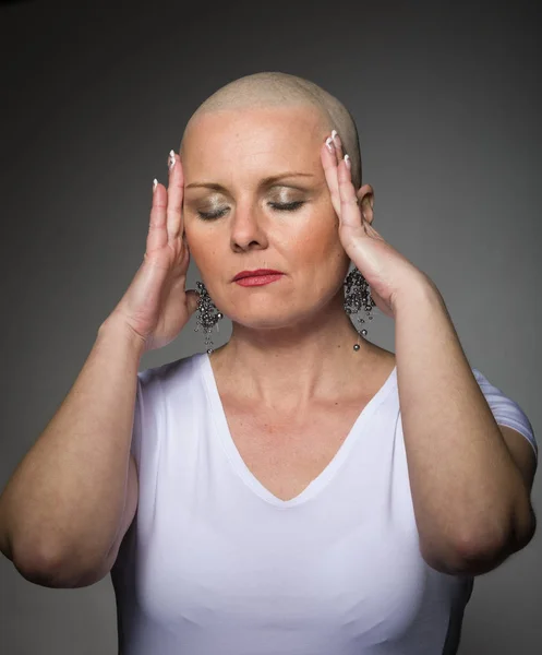 Hermosa mujer cáncer paciente sin pelo — Foto de Stock