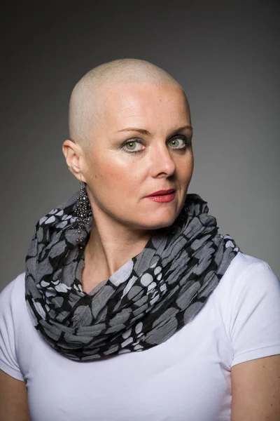 Belle femme cancer patient sans cheveux — Photo