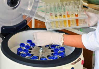 Sample loading at Elmi Centrifuge  in the laboratory of the clinic. clipart