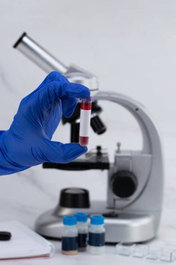 Hemşirenin elinde kan tüpü var, yakın plan. Kan testi kavramı