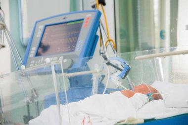Yeni doğmuş bebek kuluçka makinesinde ultraviyole ışıkta sarılık tedavisi görüyor..