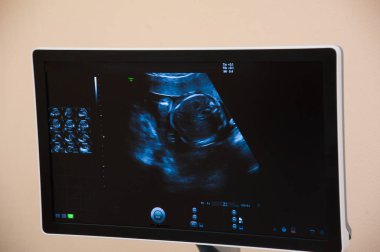 Klinikte doktor tarafından kontrol edilen hamile bir kadın.