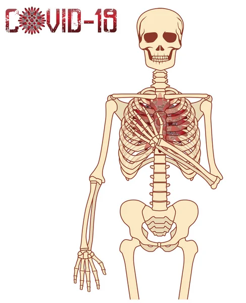Coronavirus Virüslü Insan Iskeleti Covid Izole Edilmiş Vektör Çizimi — Stok Vektör