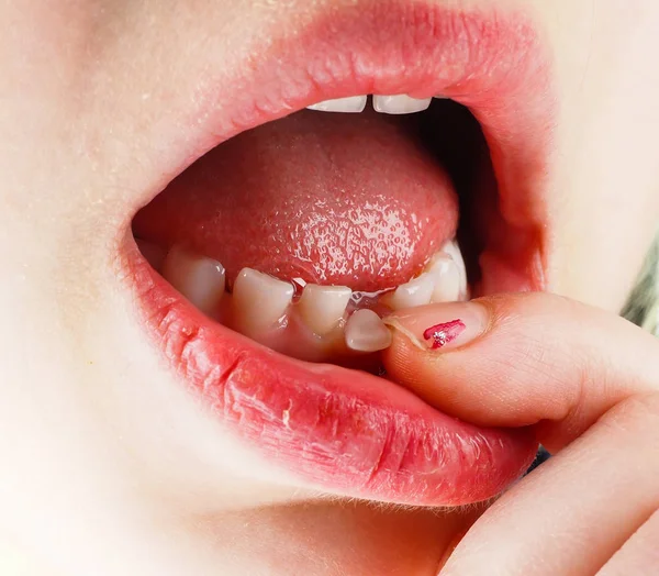 Küçük bir kız ağzına kaybetmek diş duygu parmak portre — Stok fotoğraf