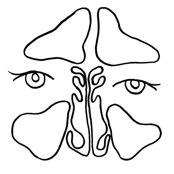 Vectorschets Tekening Van Maxillaire Sinus Neus Die Lijdt Aan Coronavirus — Stockvector