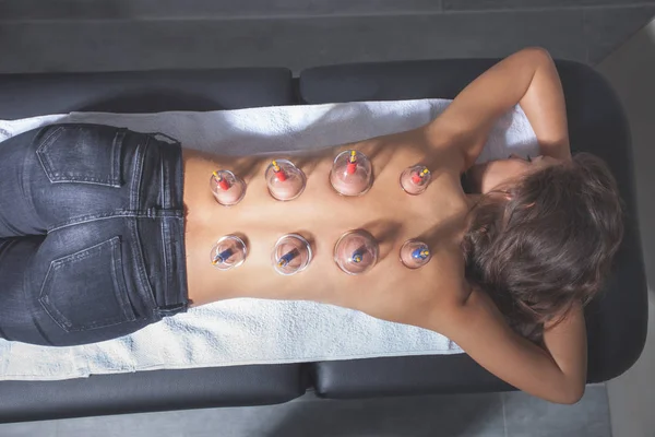 Woman on vacuum cupping massage therapy — Stock Photo, Image
