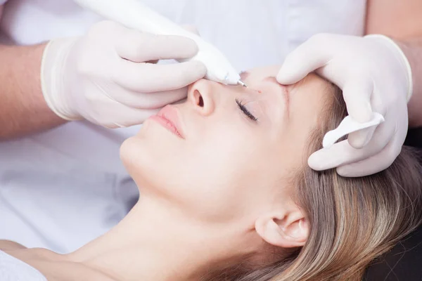 Woman during wart removal above the eye — Stock Photo, Image