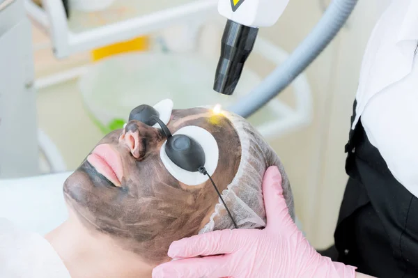 Close-up carbon face peeling prosedur. Laser pulsa kulit bersih wajah. Perawatan kosmetologi perangkat keras. Proses fototermolisis, pemanasan kulit, kulit karbon laser. Kulit wajah — Stok Foto